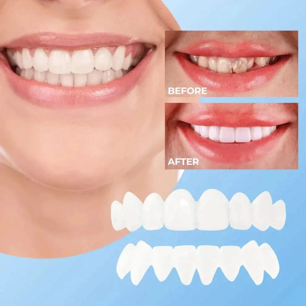 Veenora clip-on veneers for a natural-looking smile, perfect dental solution and cosmetic teeth enhancement.